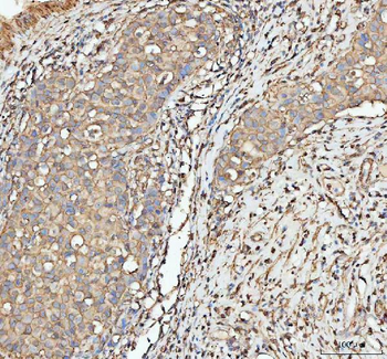 Actin/ACTA1 Rabbit Polyclonal Antibody