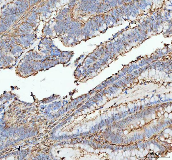 Actin/ACTA1 Rabbit Polyclonal Antibody