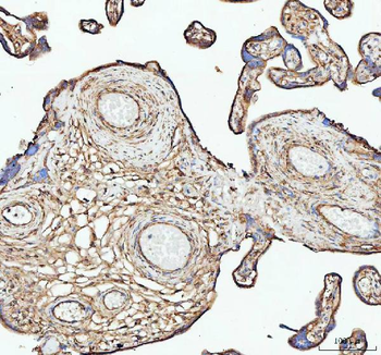 Actin/ACTA1 Rabbit Polyclonal Antibody