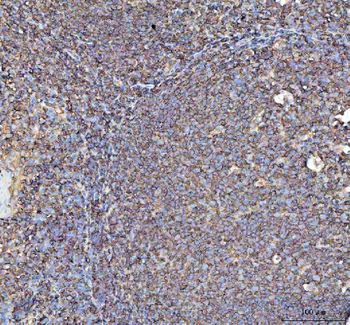 Actin/ACTA1 Rabbit Polyclonal Antibody