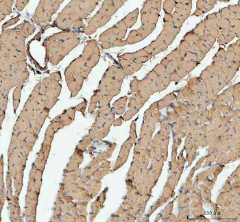 Actin/ACTA1 Rabbit Polyclonal Antibody