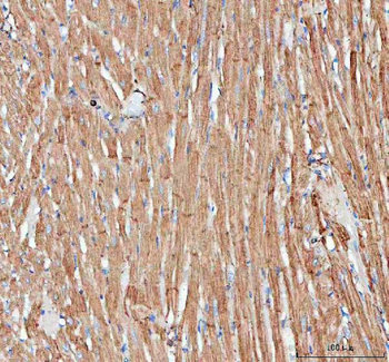 Actin/ACTA1 Rabbit Polyclonal Antibody