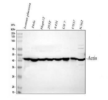 Actin/ACTA1 Rabbit Polyclonal Antibody