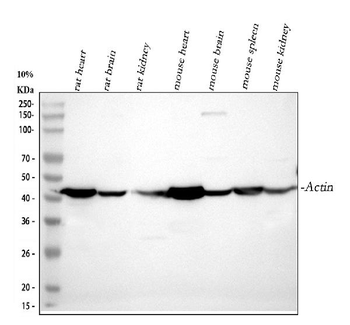 Actin/ACTA1 Rabbit Polyclonal Antibody