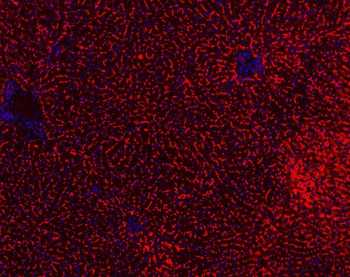 ABCB11 Rabbit Polyclonal Antibody