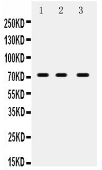 ABCG5 Rabbit Polyclonal Antibody