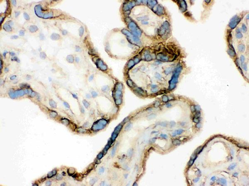 Annexin A3/ANXA3 Rabbit Polyclonal Antibody