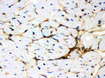 Annexin A3/ANXA3 Rabbit Polyclonal Antibody