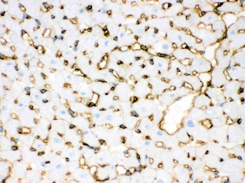Annexin A3/ANXA3 Rabbit Polyclonal Antibody