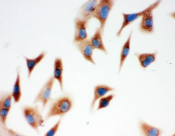 Annexin A3/ANXA3 Rabbit Polyclonal Antibody
