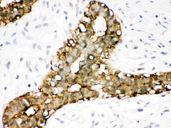 Annexin A3/ANXA3 Rabbit Polyclonal Antibody