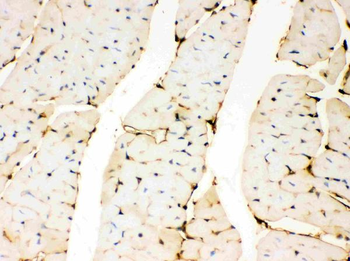 Annexin A3/ANXA3 Rabbit Polyclonal Antibody