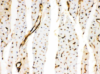 Annexin A3/ANXA3 Rabbit Polyclonal Antibody