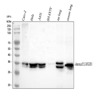 Annexin A3/ANXA3 Rabbit Polyclonal Antibody