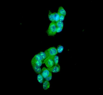 Ataxin 1/ATXN1 Rabbit Polyclonal Antibody
