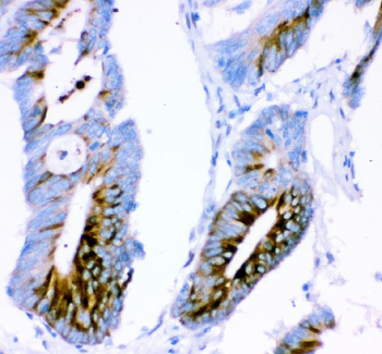 Ataxin 1/ATXN1 Rabbit Polyclonal Antibody