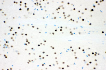 Ataxin 1/ATXN1 Rabbit Polyclonal Antibody