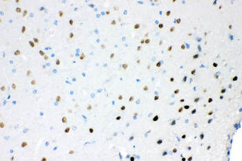Ataxin 1/ATXN1 Rabbit Polyclonal Antibody