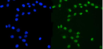 Ataxin 3/ATXN3 Rabbit Polyclonal Antibody