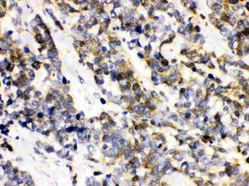 Ataxin 3/ATXN3 Rabbit Polyclonal Antibody