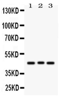 Ataxin 3/ATXN3 Rabbit Polyclonal Antibody