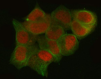 CtBP1 Rabbit Polyclonal Antibody