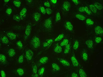 CtBP1 Rabbit Polyclonal Antibody