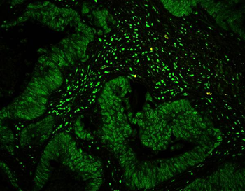 CtBP1 Rabbit Polyclonal Antibody