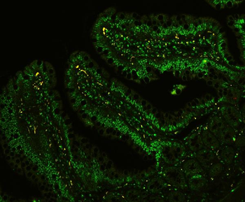CtBP1 Rabbit Polyclonal Antibody