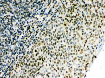 CtBP1 Rabbit Polyclonal Antibody