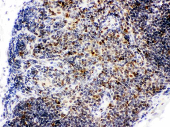 CtBP1 Rabbit Polyclonal Antibody