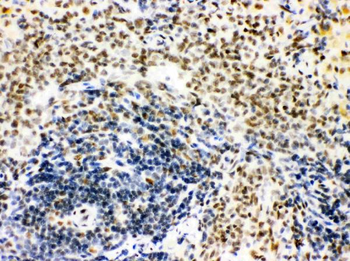 CtBP1 Rabbit Polyclonal Antibody