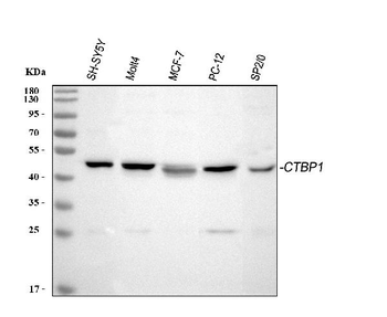 CtBP1 Rabbit Polyclonal Antibody