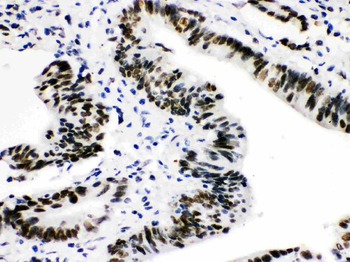 CTBP2 Rabbit Polyclonal Antibody