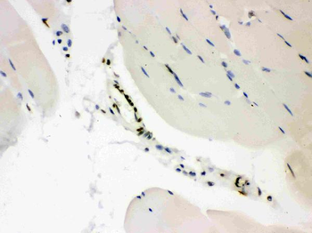 CTBP2 Rabbit Polyclonal Antibody