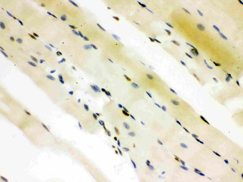 CTBP2 Rabbit Polyclonal Antibody