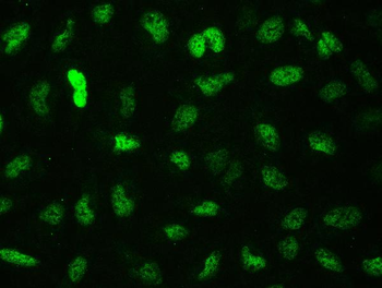 CTBP2 Rabbit Polyclonal Antibody