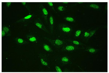 CTBP2 Rabbit Polyclonal Antibody