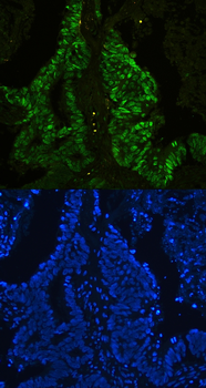 CTBP2 Rabbit Polyclonal Antibody