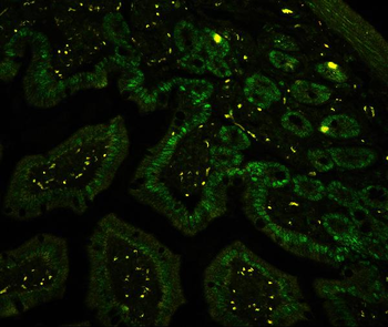 CTBP2 Rabbit Polyclonal Antibody