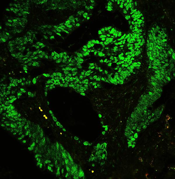 CTBP2 Rabbit Polyclonal Antibody