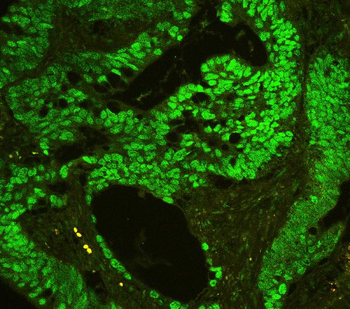 CTBP2 Rabbit Polyclonal Antibody