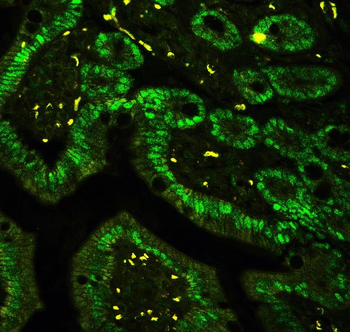 CTBP2 Rabbit Polyclonal Antibody