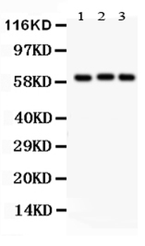 Heparanase 1/HPSE Rabbit Polyclonal Antibody