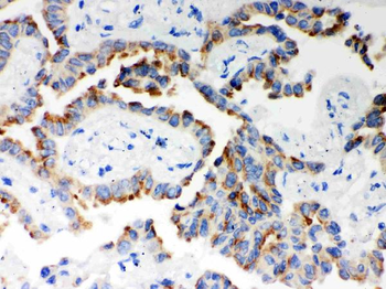 ITPR3 Rabbit Polyclonal Antibody