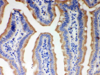 ITPR3 Rabbit Polyclonal Antibody