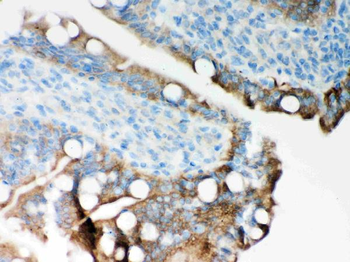 ITPR3 Rabbit Polyclonal Antibody