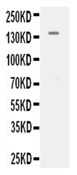 VEGF Receptor 2/KDR Rabbit Polyclonal Antibody