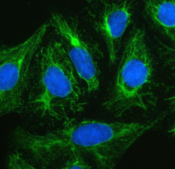 Plectin Rabbit Polyclonal Antibody