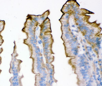 Plectin Rabbit Polyclonal Antibody